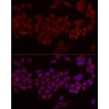 Immunofluorescence - Anti-MADH7/SMAD7 Antibody (A80992) - Antibodies.com
