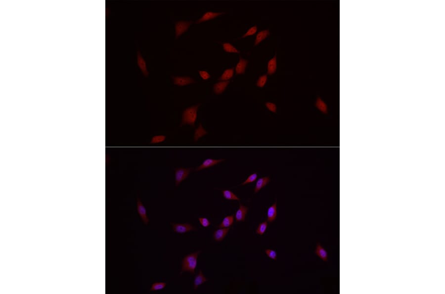 Immunofluorescence - Anti-MADH7/SMAD7 Antibody (A80992) - Antibodies.com