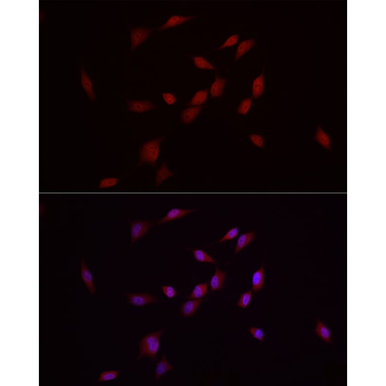 Immunofluorescence - Anti-MADH7/SMAD7 Antibody (A80992) - Antibodies.com