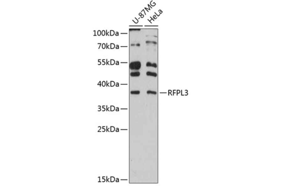 Western Blot - Anti-RFPL3 Antibody (A80993) - Antibodies.com