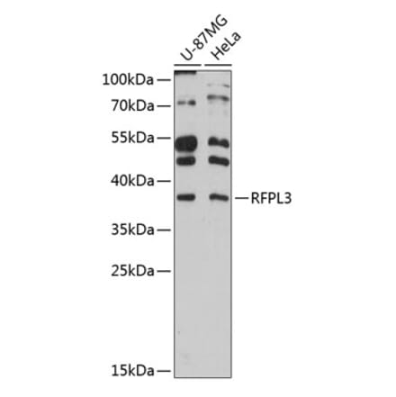 Western Blot - Anti-RFPL3 Antibody (A80993) - Antibodies.com