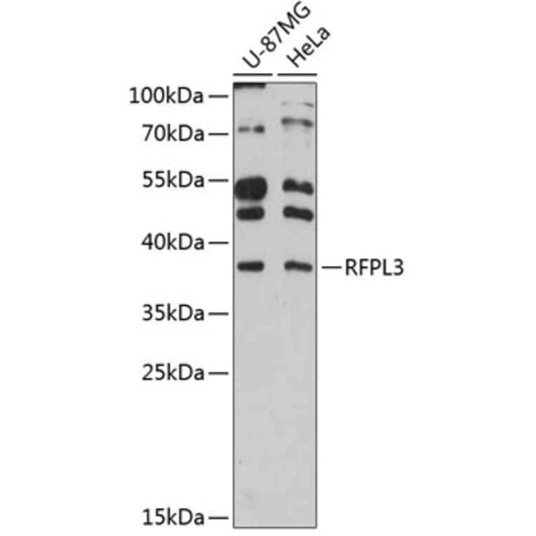 Western Blot - Anti-RFPL3 Antibody (A80993) - Antibodies.com