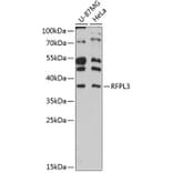 Western Blot - Anti-RFPL3 Antibody (A80993) - Antibodies.com