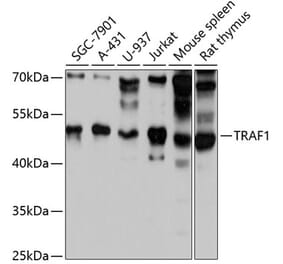 Western Blot - Anti-TRAF1 Antibody (A80995) - Antibodies.com