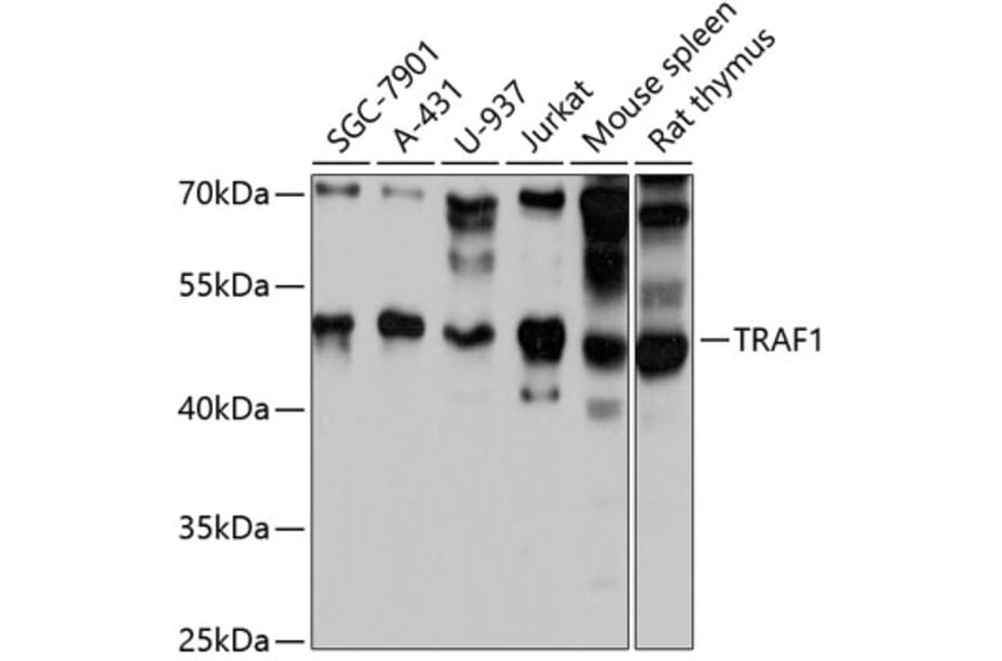 Western Blot - Anti-TRAF1 Antibody (A80995) - Antibodies.com