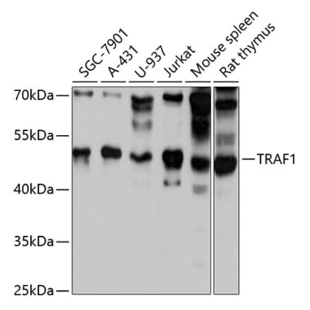 Western Blot - Anti-TRAF1 Antibody (A80995) - Antibodies.com