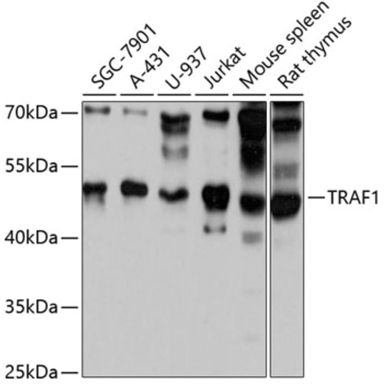 Western Blot - Anti-TRAF1 Antibody (A80995) - Antibodies.com