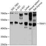 Western Blot - Anti-TRAF1 Antibody (A80995) - Antibodies.com