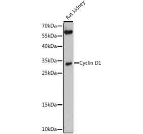 Western Blot - Anti-Cyclin D1 Antibody (A80996) - Antibodies.com