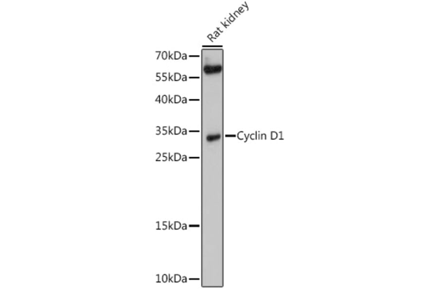Western Blot - Anti-Cyclin D1 Antibody (A80996) - Antibodies.com