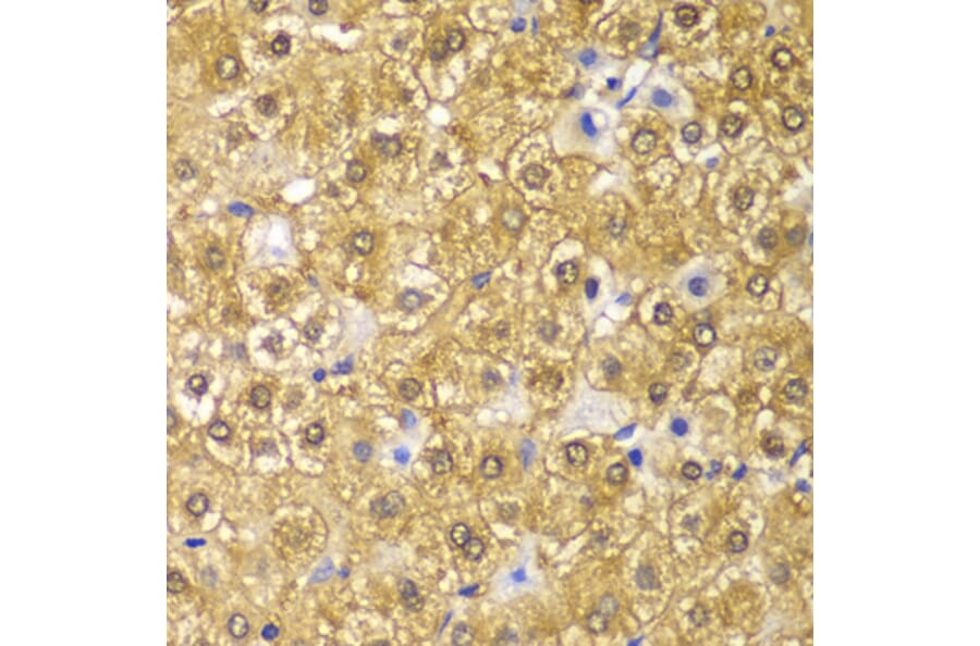 Immunohistochemistry - Anti-Cyclin D1 Antibody (A80996) - Antibodies.com