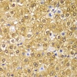 Immunohistochemistry - Anti-Cyclin D1 Antibody (A80996) - Antibodies.com