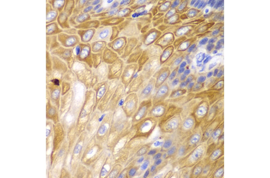 Immunohistochemistry - Anti-Cyclin D1 Antibody (A80996) - Antibodies.com