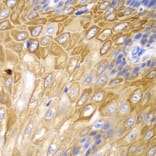 Immunohistochemistry - Anti-Cyclin D1 Antibody (A80996) - Antibodies.com