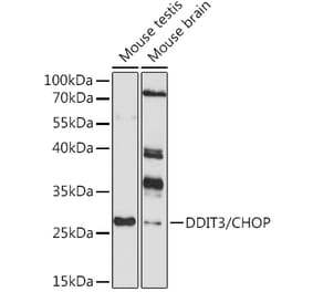 Western Blot - Anti-DDIT3 Antibody (A80997) - Antibodies.com