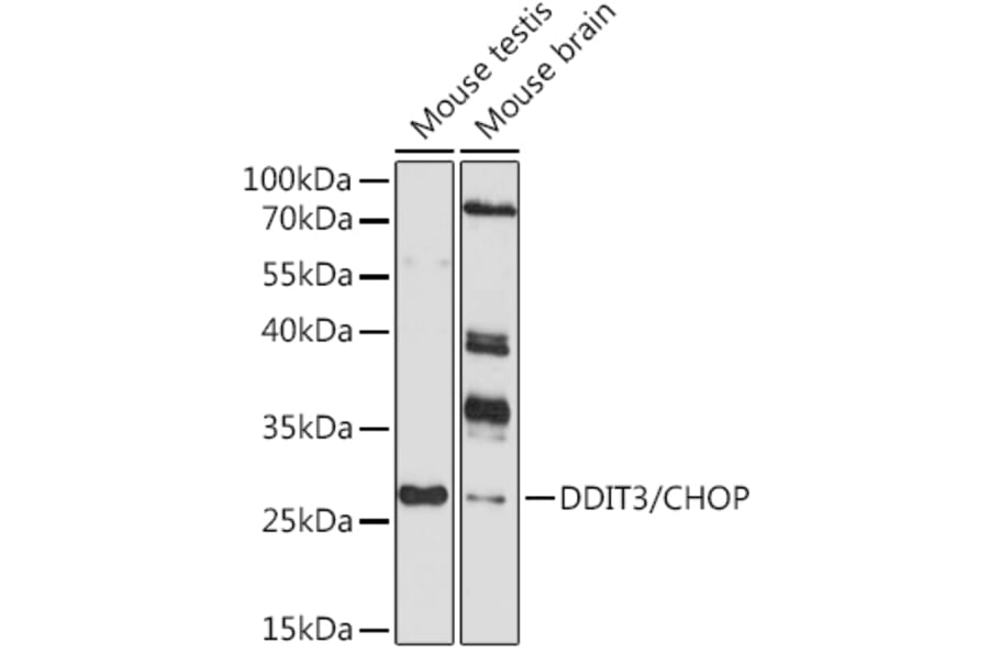 Western Blot - Anti-DDIT3 Antibody (A80997) - Antibodies.com