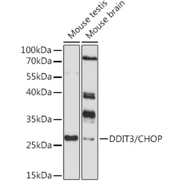 Western Blot - Anti-DDIT3 Antibody (A80997) - Antibodies.com