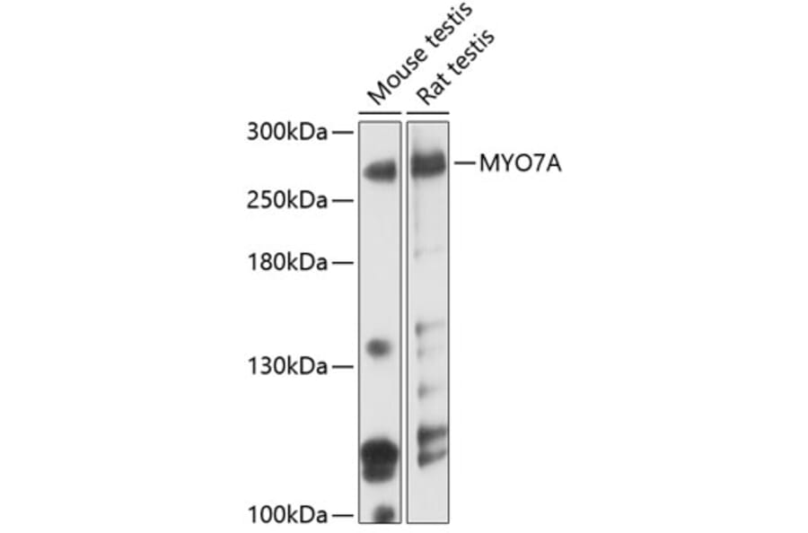 Western Blot - Anti-Myosin VIIa/MYO7A Antibody (A80998) - Antibodies.com