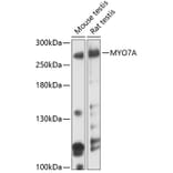 Western Blot - Anti-Myosin VIIa/MYO7A Antibody (A80998) - Antibodies.com