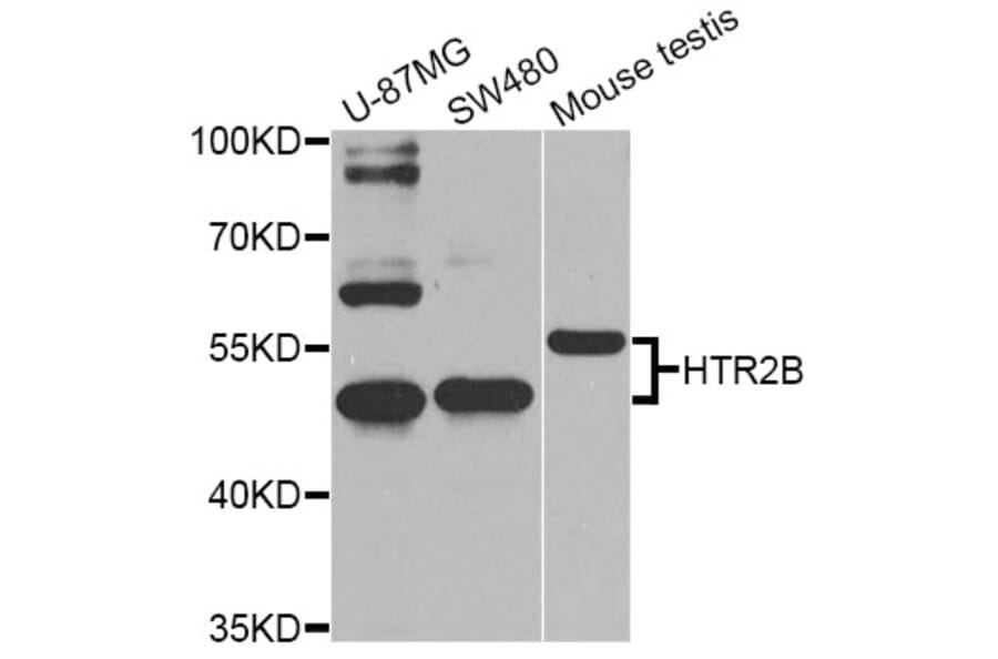 Western Blot - Anti-HTR2B Antibody (A2651) - Antibodies.com
