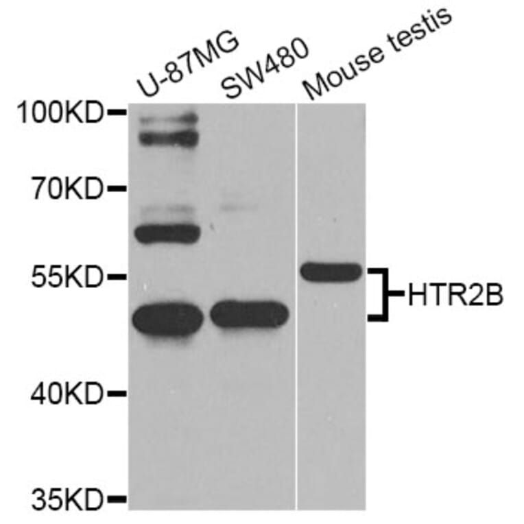 Western Blot - Anti-HTR2B Antibody (A2651) - Antibodies.com