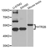 Western Blot - Anti-HTR2B Antibody (A2651) - Antibodies.com