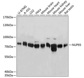 Western Blot - Anti-NUP93 Antibody (A81000) - Antibodies.com