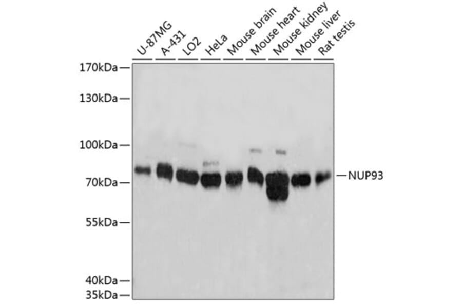 Western Blot - Anti-NUP93 Antibody (A81000) - Antibodies.com