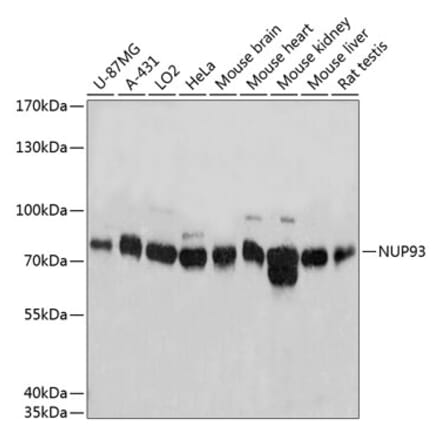 Western Blot - Anti-NUP93 Antibody (A81000) - Antibodies.com