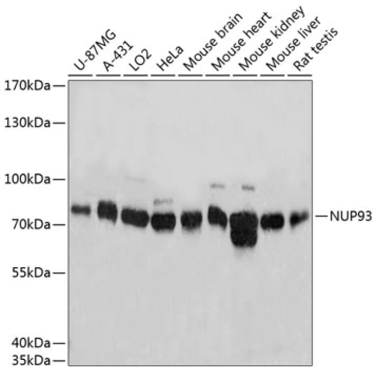 Western Blot - Anti-NUP93 Antibody (A81000) - Antibodies.com