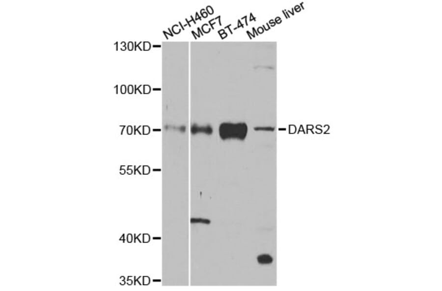 Western Blot - Anti-DARS2 Antibody (A4814) - Antibodies.com