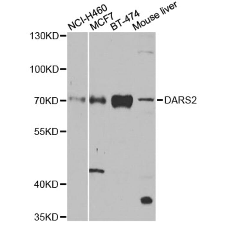 Western Blot - Anti-DARS2 Antibody (A4814) - Antibodies.com