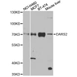 Western Blot - Anti-DARS2 Antibody (A4814) - Antibodies.com