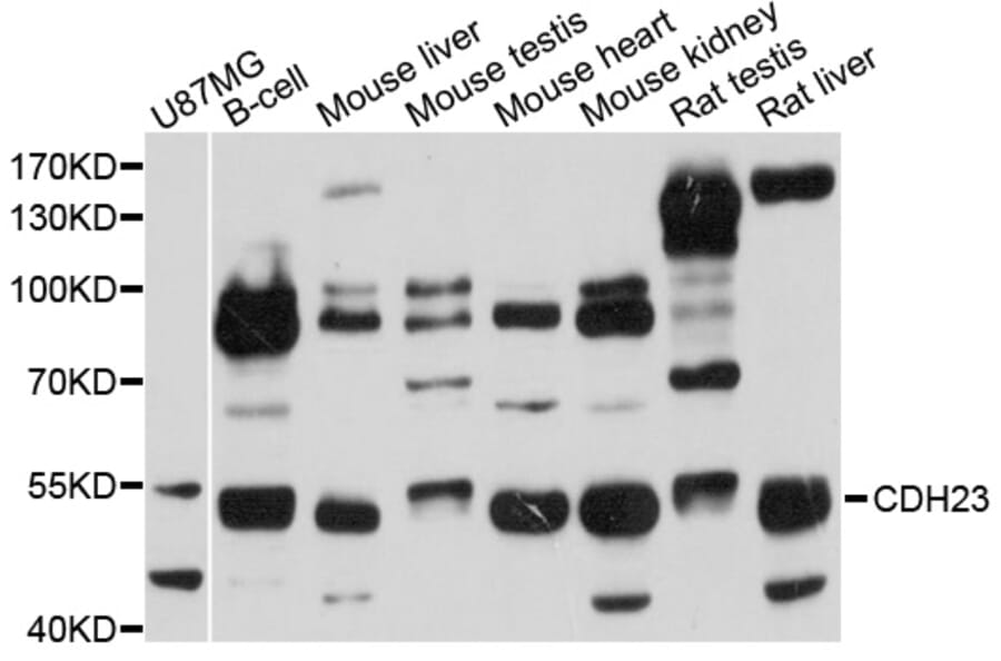 Western Blot - Anti-CDH23 Antibody (A4918) - Antibodies.com