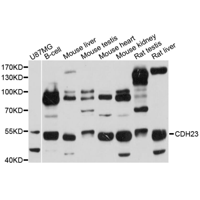 Western Blot - Anti-CDH23 Antibody (A4918) - Antibodies.com