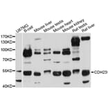 Western Blot - Anti-CDH23 Antibody (A4918) - Antibodies.com
