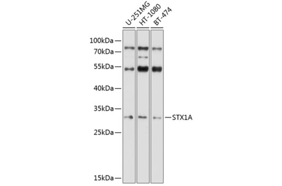 Western Blot - Anti-Syntaxin 1a Antibody (A81003) - Antibodies.com