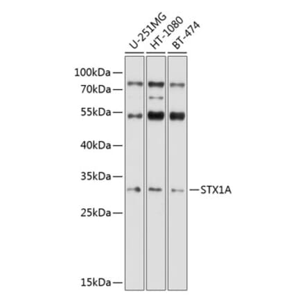 Western Blot - Anti-Syntaxin 1a Antibody (A81003) - Antibodies.com