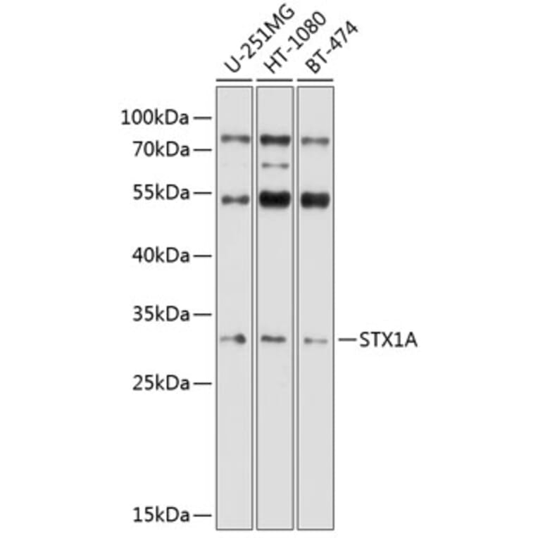 Western Blot - Anti-Syntaxin 1a Antibody (A81003) - Antibodies.com