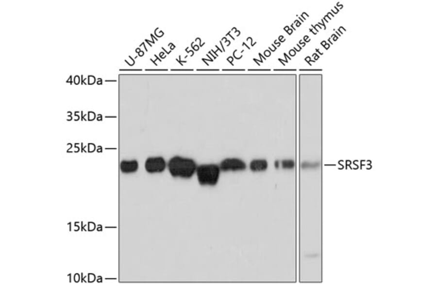 Western Blot - Anti-SRSF3 Antibody (A81004) - Antibodies.com