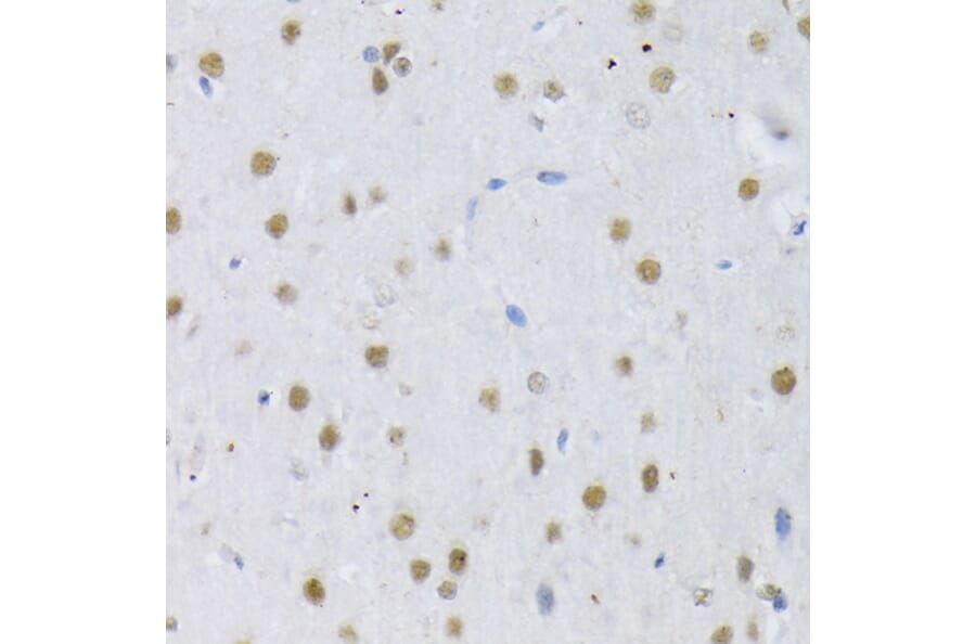 Immunohistochemistry - Anti-SRSF3 Antibody (A81004) - Antibodies.com