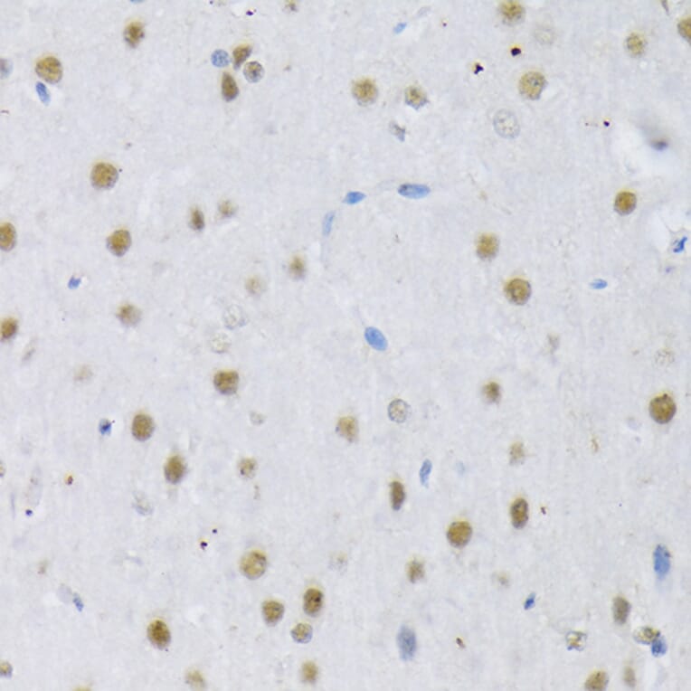 Immunohistochemistry - Anti-SRSF3 Antibody (A81004) - Antibodies.com