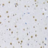 Immunohistochemistry - Anti-SRSF3 Antibody (A81004) - Antibodies.com