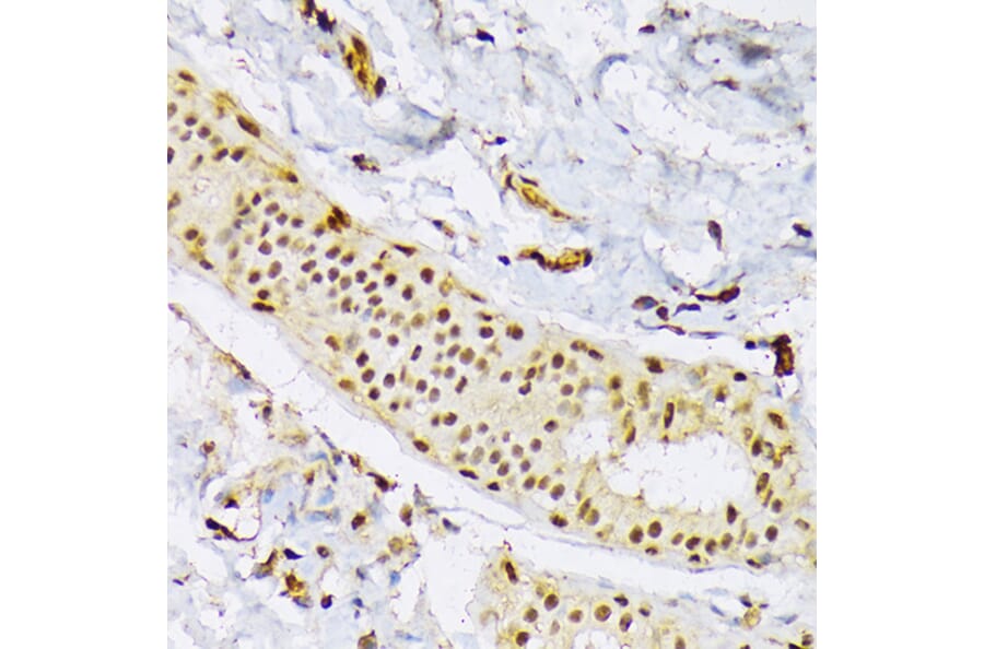 Immunohistochemistry - Anti-SRSF3 Antibody (A81004) - Antibodies.com