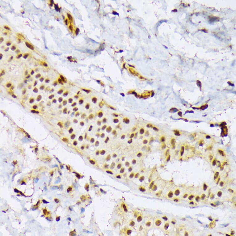 Immunohistochemistry - Anti-SRSF3 Antibody (A81004) - Antibodies.com