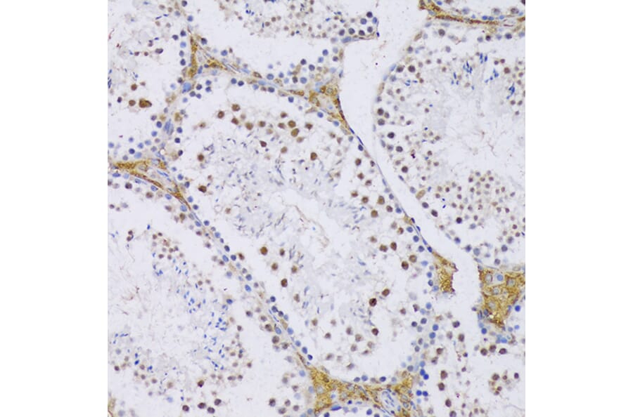 Immunohistochemistry - Anti-SRSF3 Antibody (A81004) - Antibodies.com