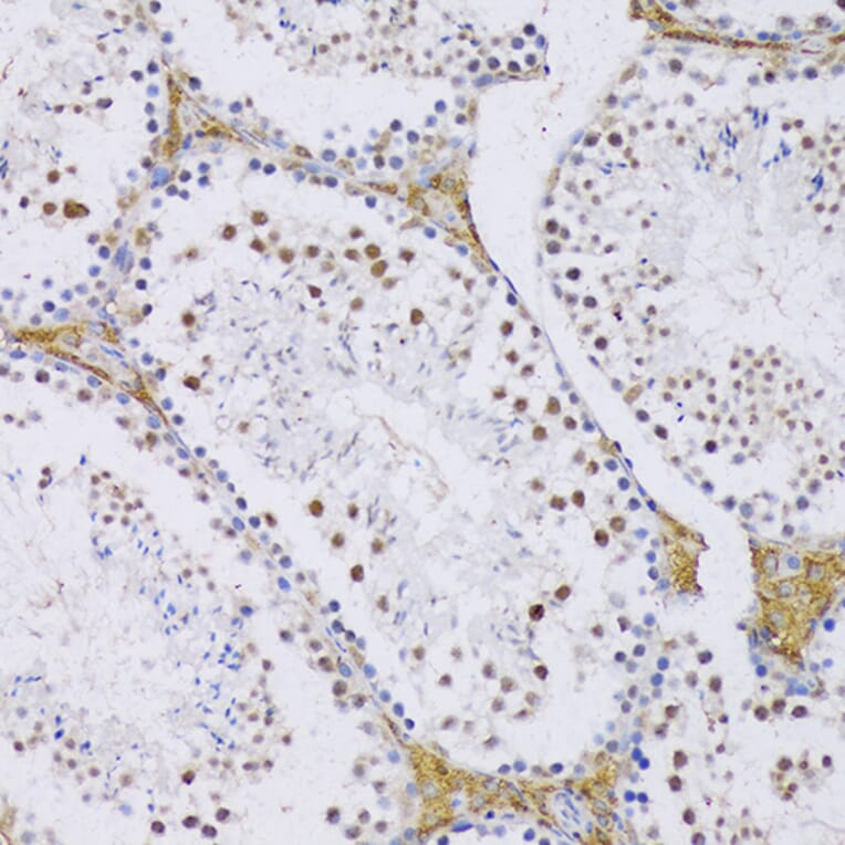 Immunohistochemistry - Anti-SRSF3 Antibody (A81004) - Antibodies.com