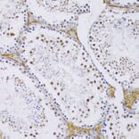 Immunohistochemistry - Anti-SRSF3 Antibody (A81004) - Antibodies.com