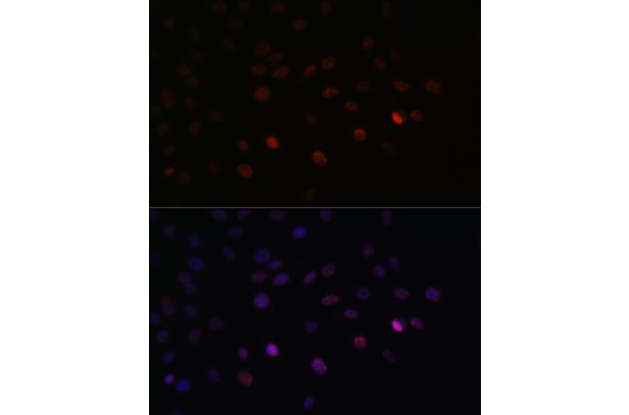 Immunofluorescence - Anti-SRSF3 Antibody (A81004) - Antibodies.com