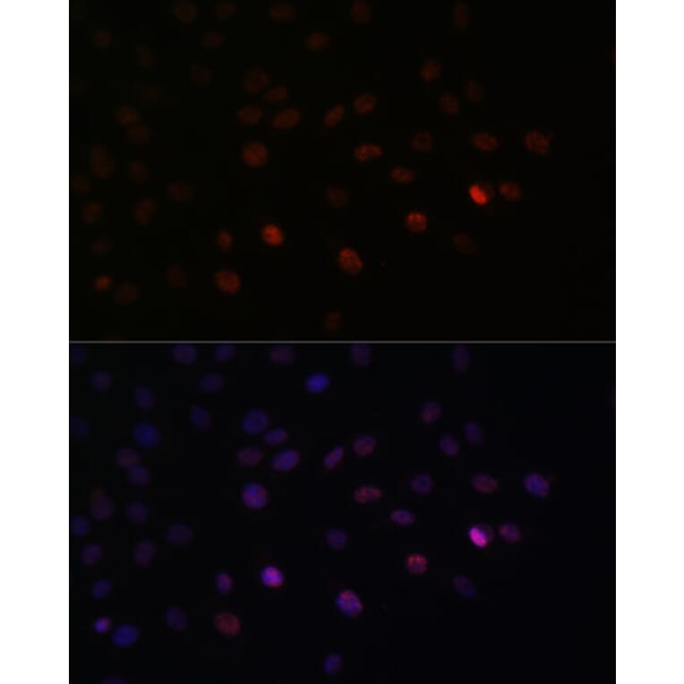 Immunofluorescence - Anti-SRSF3 Antibody (A81004) - Antibodies.com